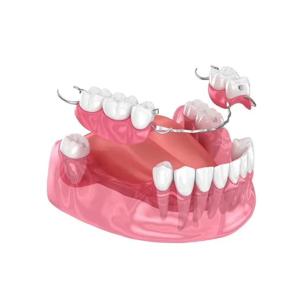 denture implants near orange city