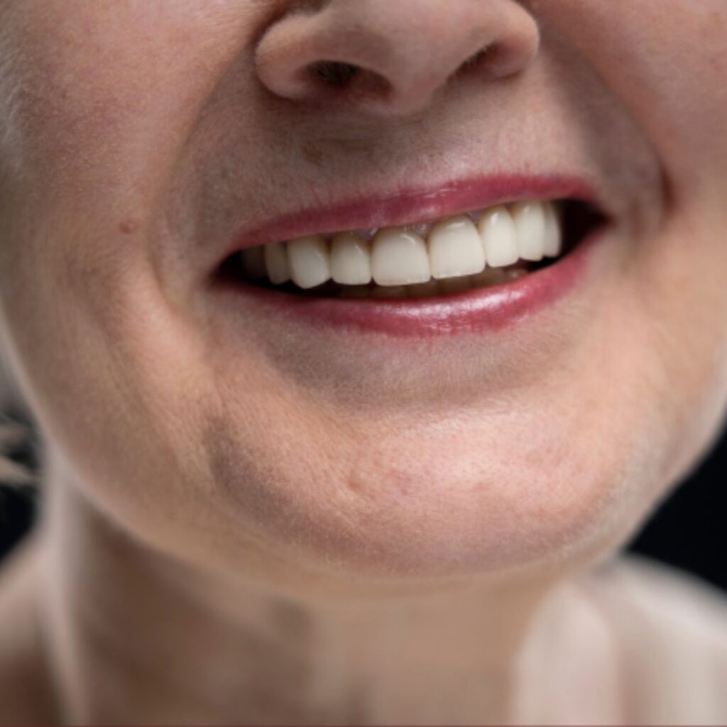 dentures orange county ca