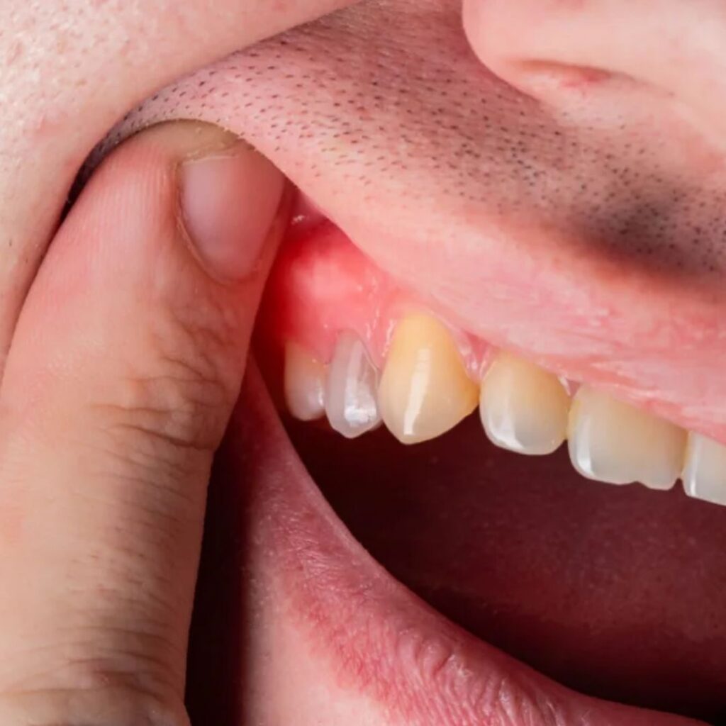 root canals orange